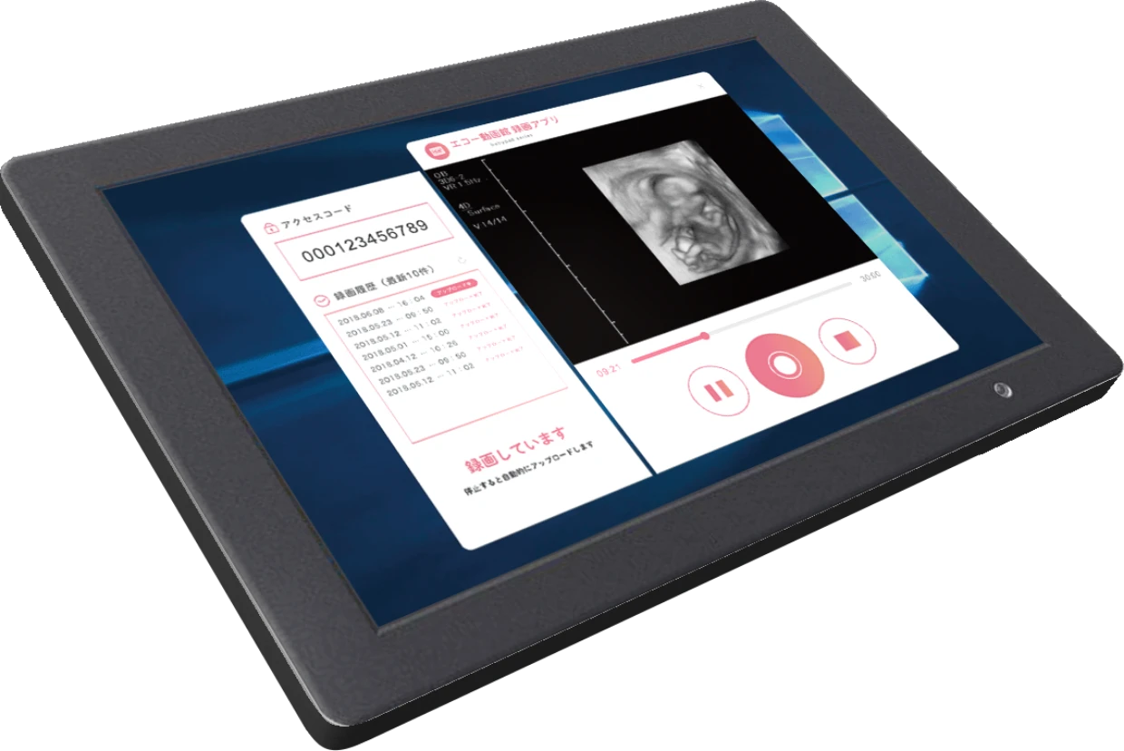 エコー動画館の録画・再生画面が表示されたタブレット端末